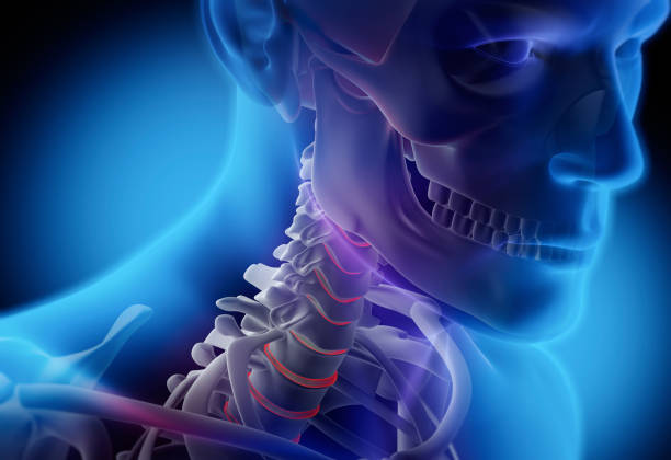 Neck Dissection